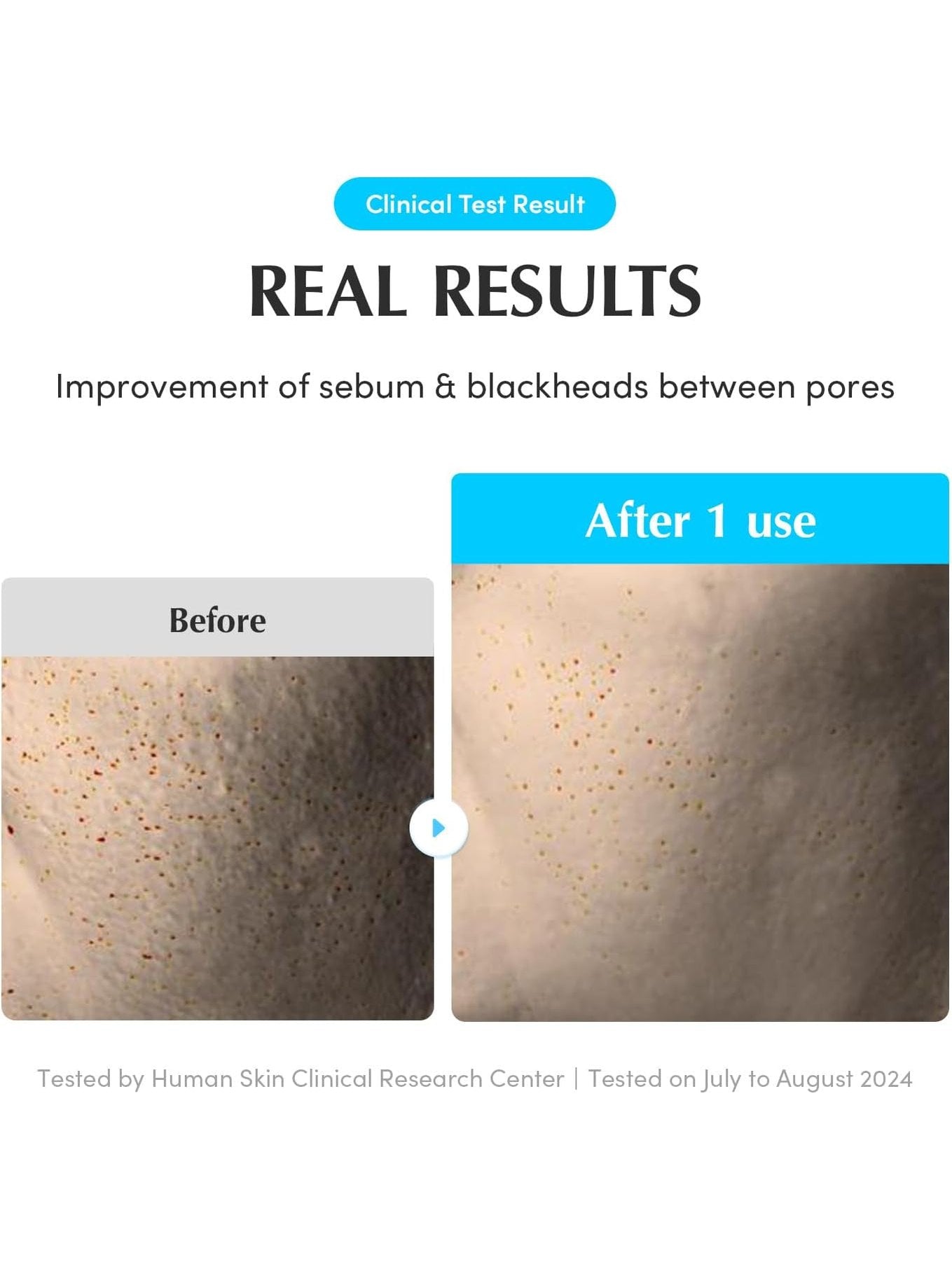 Swimming Pool Toner Pads